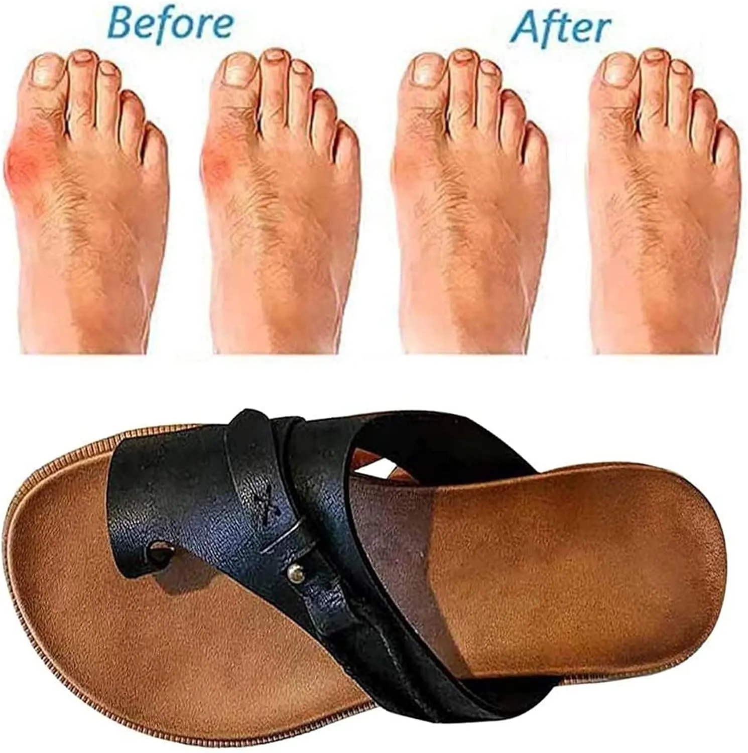 BBPM Women's Orthotic Sandals, Bunion Correction, Comfortable Platform Sandals, Black, EU40/US8