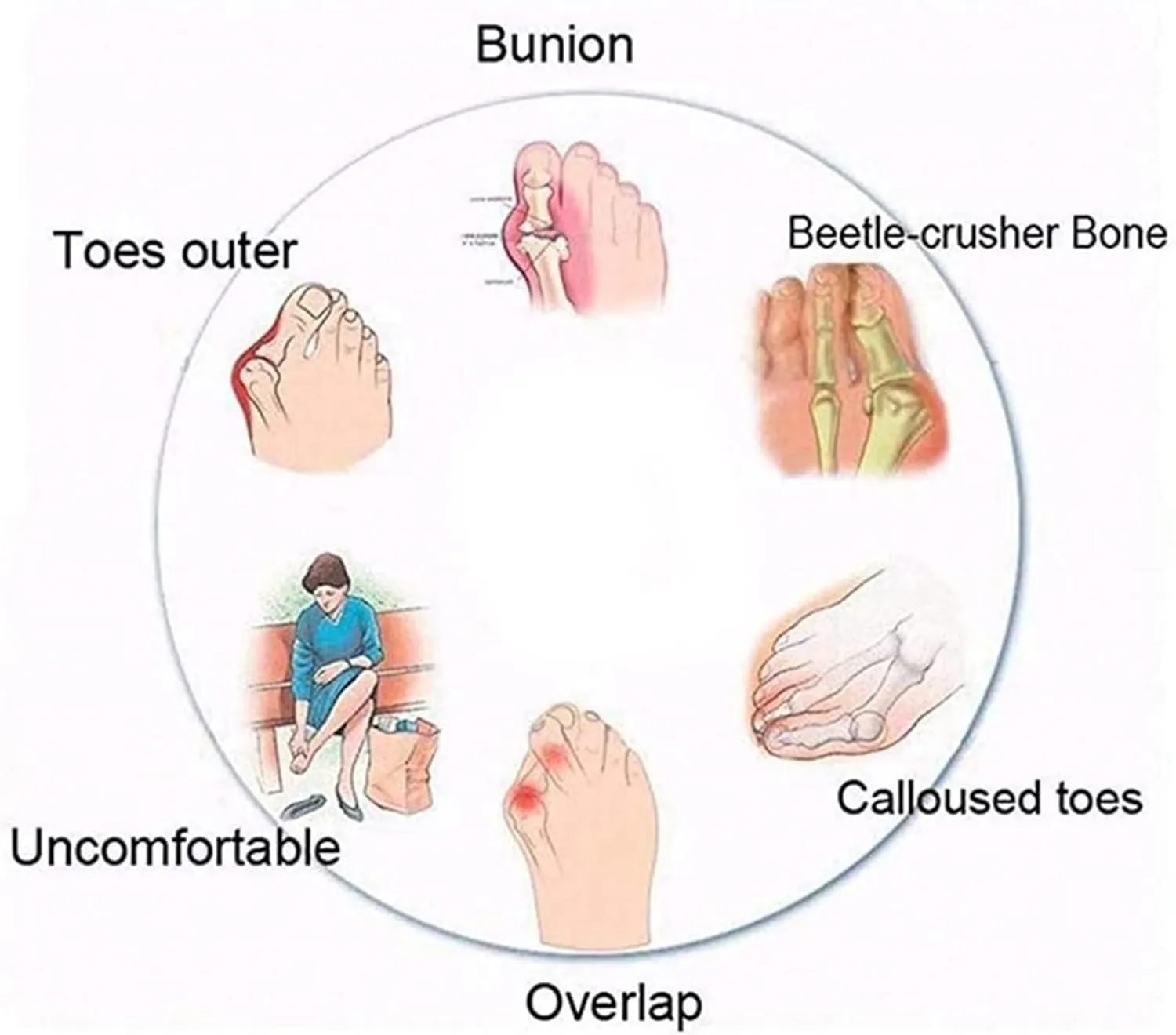 Fashion Split Toe Bunion Corrector Sandals Men, Non-Slip Orthotic Leather Men's Sandals Bunion Relief